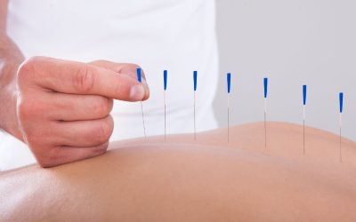 Unlock better health with acupuncture services in Newark, CA: A holistic approach